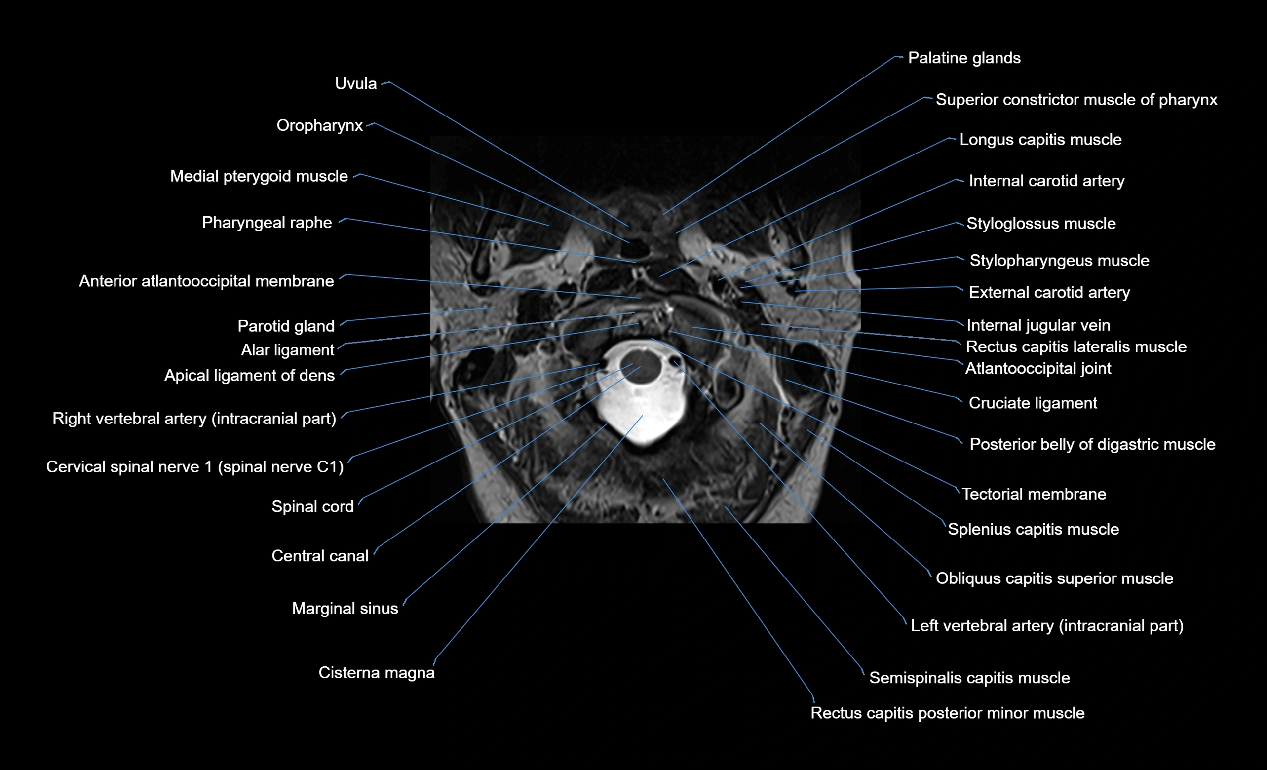 cervical spine cross sectional MRI anatomy  3T MRI axial  image-img-00001-00003.webp